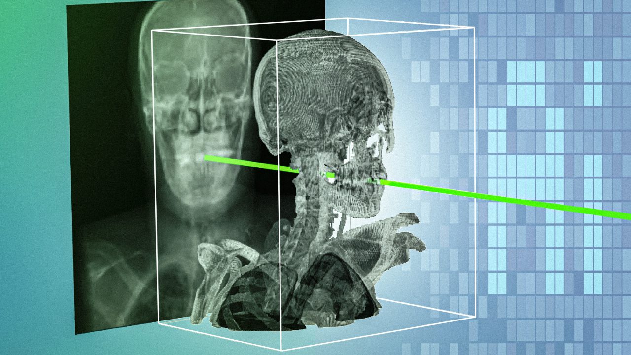 New AI technique could make minimally invasive surgeries safer and more precise